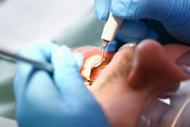 Best Emergency Treatment for Jaw Pain or Injury in Centreville, MD