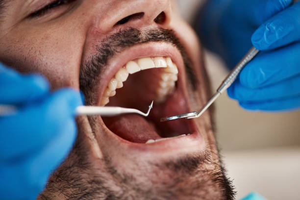 Best Emergency Denture Repair in Centreville, MD